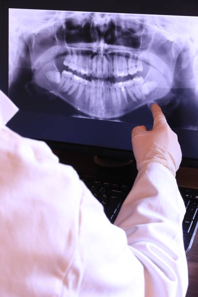 Best Emergency Wisdom Tooth Extraction in Brunswick, NC
