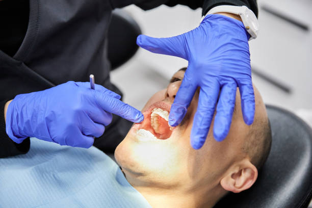 Best Dental Abscess Treatment in Brunswick, NC